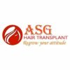 PRP Treatment in Ludhiana   ASG Hair Transplant Centre